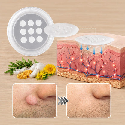 🚚  Mrevbsin® 2 az 1-ben mikrotűs és hidrokolloid tapasz🧑‍⚕️ | Kiálló anyajegyek, aknék, lapos szemölcsök és bőrnövedékek eltávolítására | Segít csökkenteni a ráncokat, hegeket és bőrhibákat