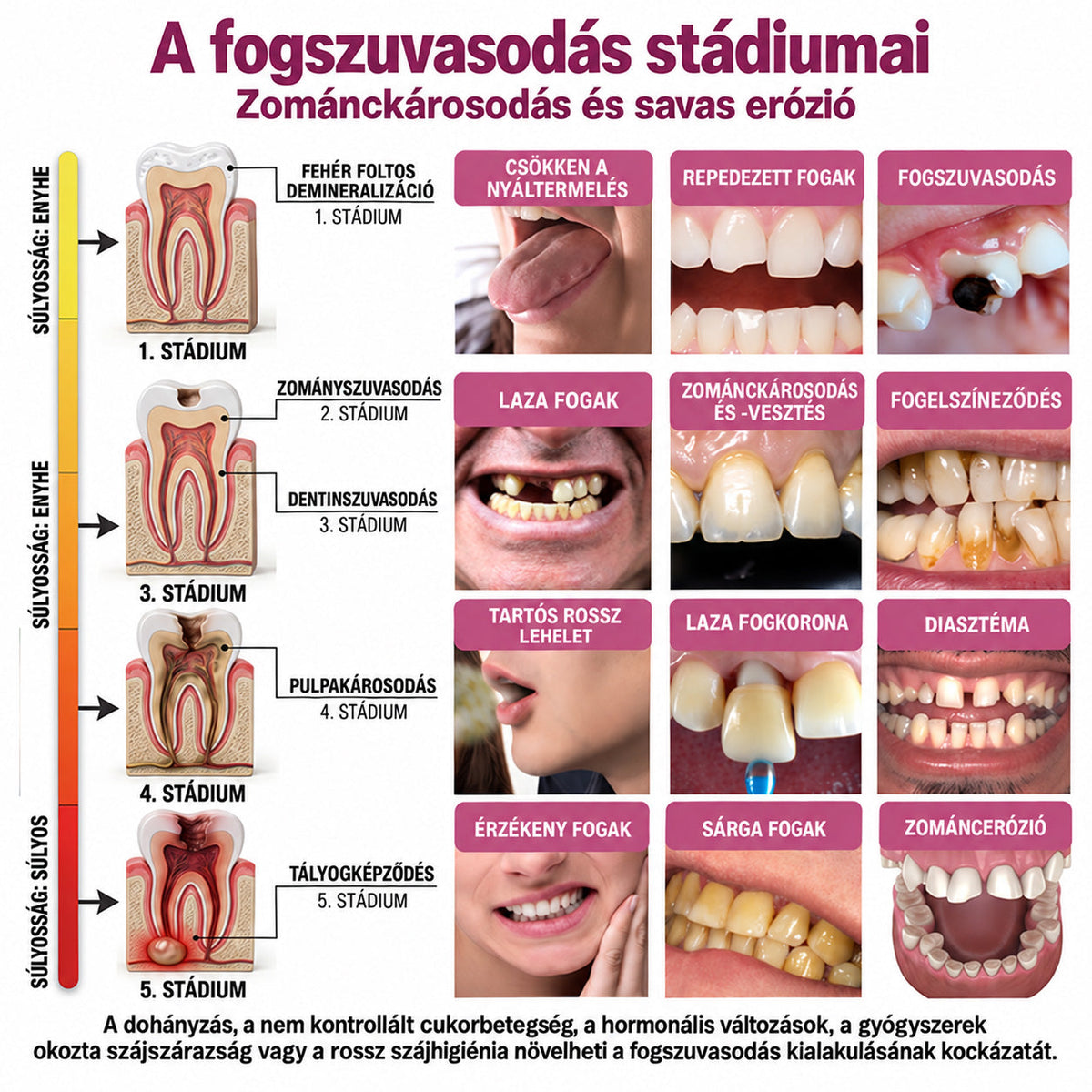 ⭐👨‍⚕️🦷Mrevbsin® DenPerm – Természetes fogzománc-töltő gél a fogszuvasodás helyreállítására🐟2️⃣