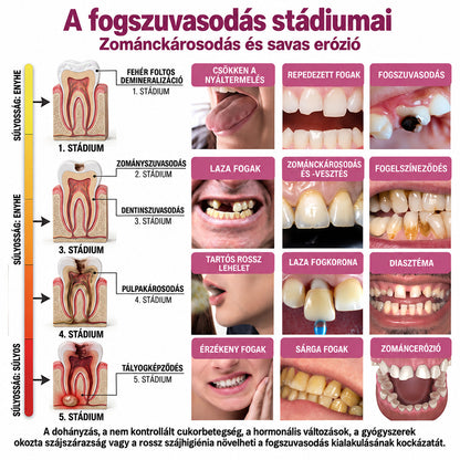 ⭐👨‍⚕️🦷Mrevbsin® DenPerm – Természetes fogzománc-töltő gél a fogszuvasodás helyreállítására🐟2️⃣