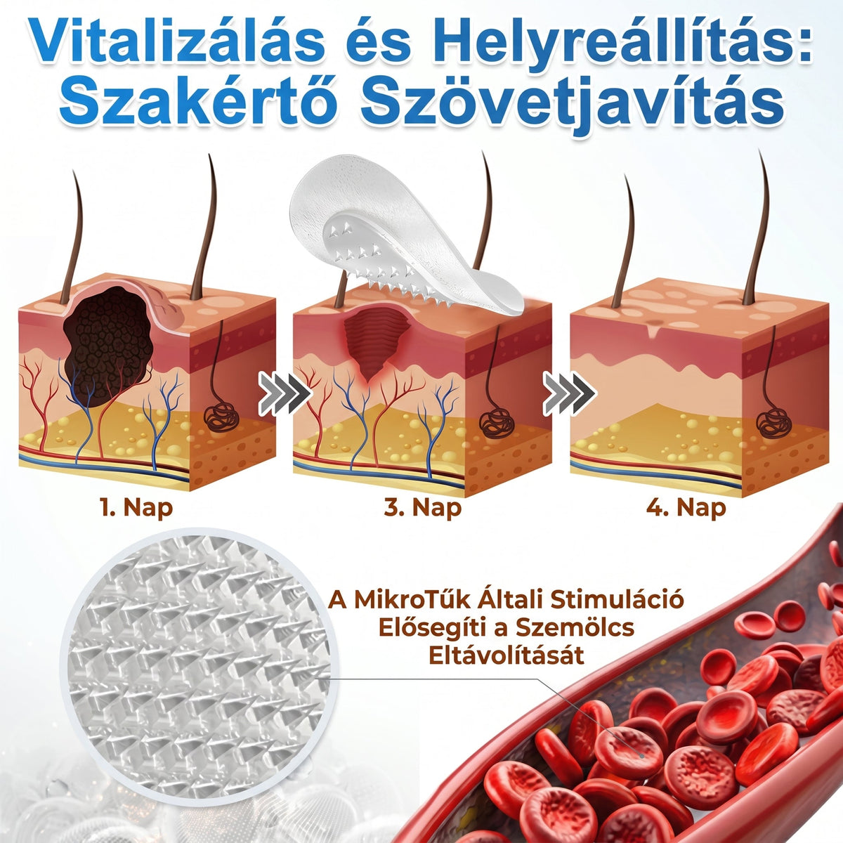 🚚  Mrevbsin® 2 az 1-ben mikrotűs és hidrokolloid tapasz🧑‍⚕️ | Kiálló anyajegyek, aknék, lapos szemölcsök és bőrnövedékek eltávolítására | Segít csökkenteni a ráncokat, hegeket és bőrhibákat