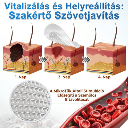 🚚  Mrevbsin® 2 az 1-ben mikrotűs és hidrokolloid tapasz🧑‍⚕️ | Kiálló anyajegyek, aknék, lapos szemölcsök és bőrnövedékek eltávolítására | Segít csökkenteni a ráncokat, hegeket és bőrhibákat