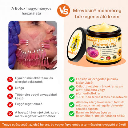 🔥 Hivatalos márkabolt | Mrevbsin® Méhméreg Pro Komplex Krém – Bőrfeszesítő minden bőrtípusra