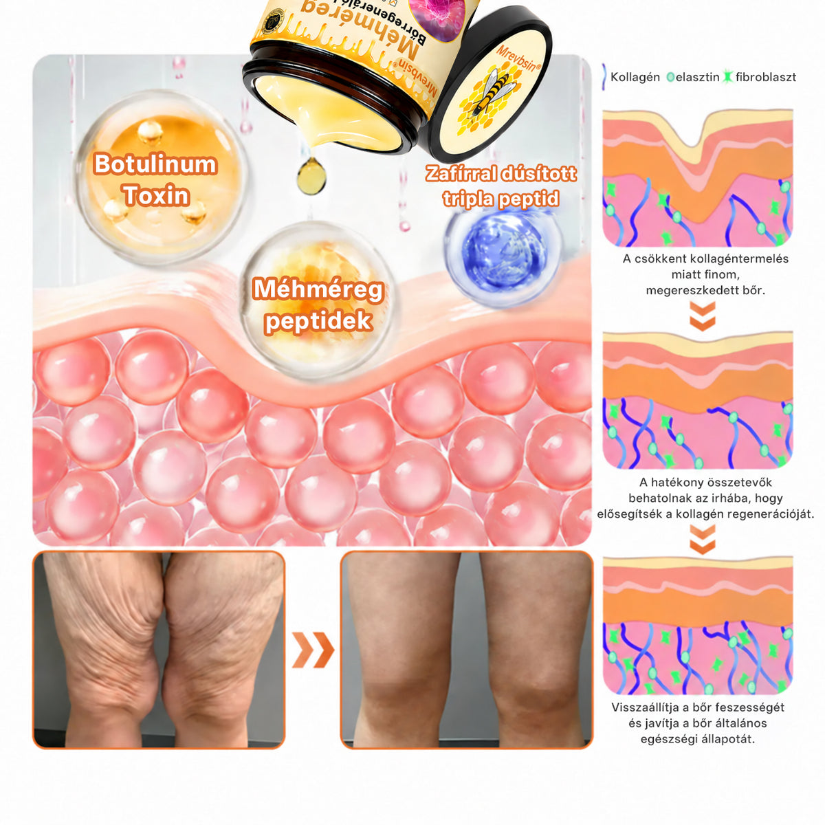 🔥 Hivatalos márkabolt | Mrevbsin® Méhméreg Pro Komplex Krém – Bőrfeszesítő minden bőrtípusra