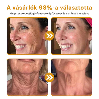 🔥 Hivatalos márkabolt | Mrevbsin® Méhméreg Pro Komplex Krém – Bőrfeszesítő minden bőrtípusra