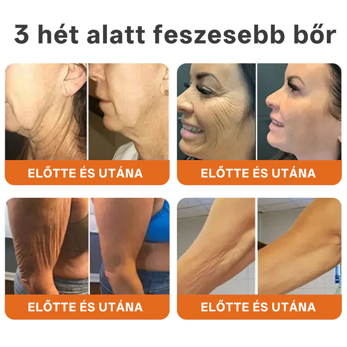 🔥 Hivatalos márkabolt | Mrevbsin® Méhméreg Pro Komplex Krém – Bőrfeszesítő minden bőrtípusra