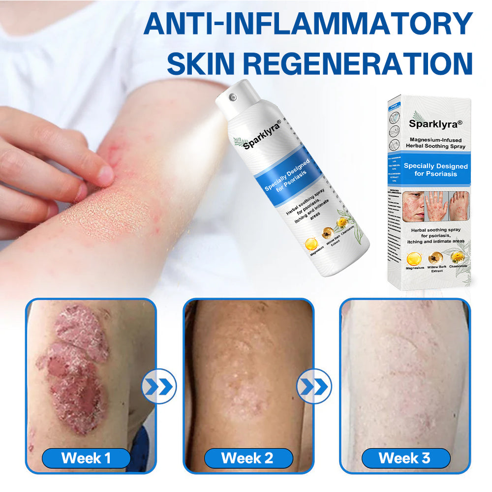 💥💥Official shop✅: Sparklyra® Herbal magnesium spray for psoriasis