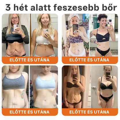 🔥 Hivatalos márkabolt | Mrevbsin® Méhméreg Pro Komplex Krém – Bőrfeszesítő minden bőrtípusra