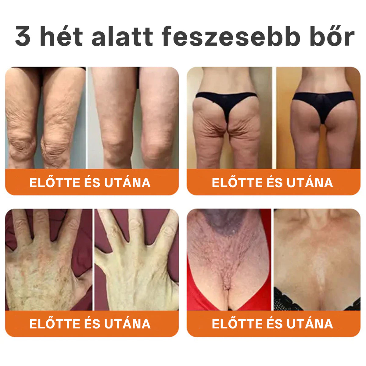 🔥 Hivatalos márkabolt | Mrevbsin® Méhméreg Pro Komplex Krém – Bőrfeszesítő minden bőrtípusra