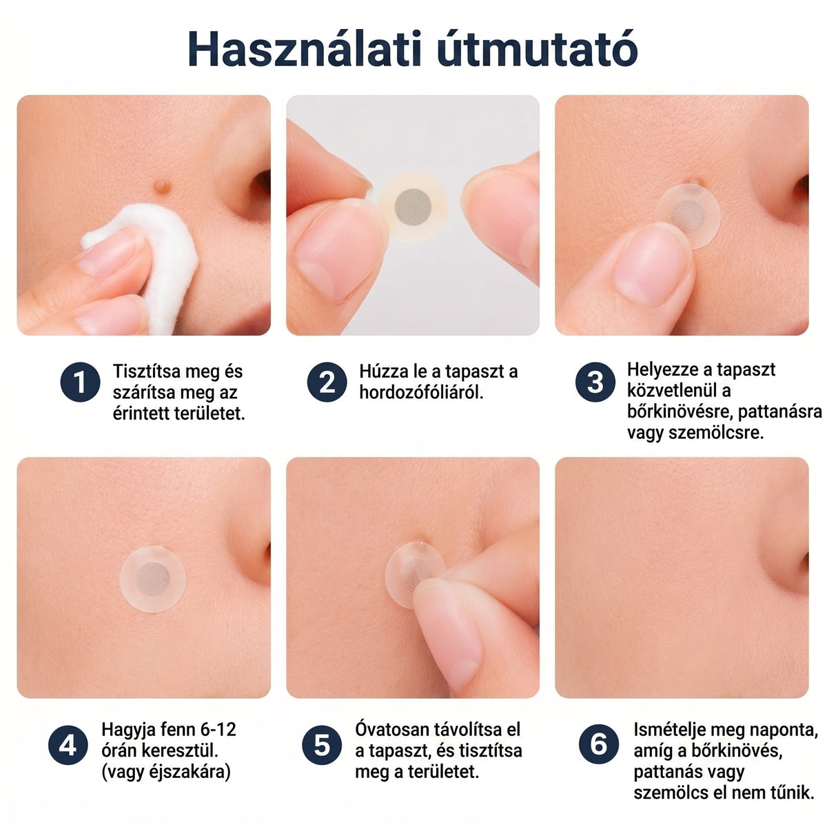 🚚  Mrevbsin® 2 az 1-ben mikrotűs és hidrokolloid tapasz🧑‍⚕️ | Kiálló anyajegyek, aknék, lapos szemölcsök és bőrnövedékek eltávolítására | Segít csökkenteni a ráncokat, hegeket és bőrhibákat