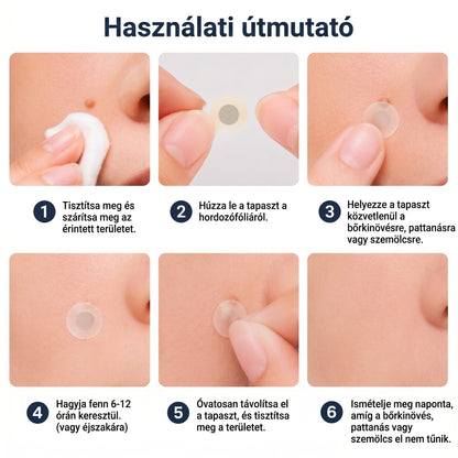 🚚  Mrevbsin® 2 az 1-ben mikrotűs és hidrokolloid tapasz🧑‍⚕️ | Kiálló anyajegyek, aknék, lapos szemölcsök és bőrnövedékek eltávolítására | Segít csökkenteni a ráncokat, hegeket és bőrhibákat