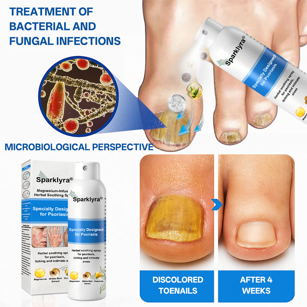 💥💥Official shop✅: Sparklyra® Herbal magnesium spray for psoriasis