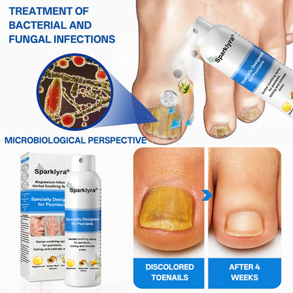💥💥Official shop✅: Sparklyra® Herbal magnesium spray for psoriasis
