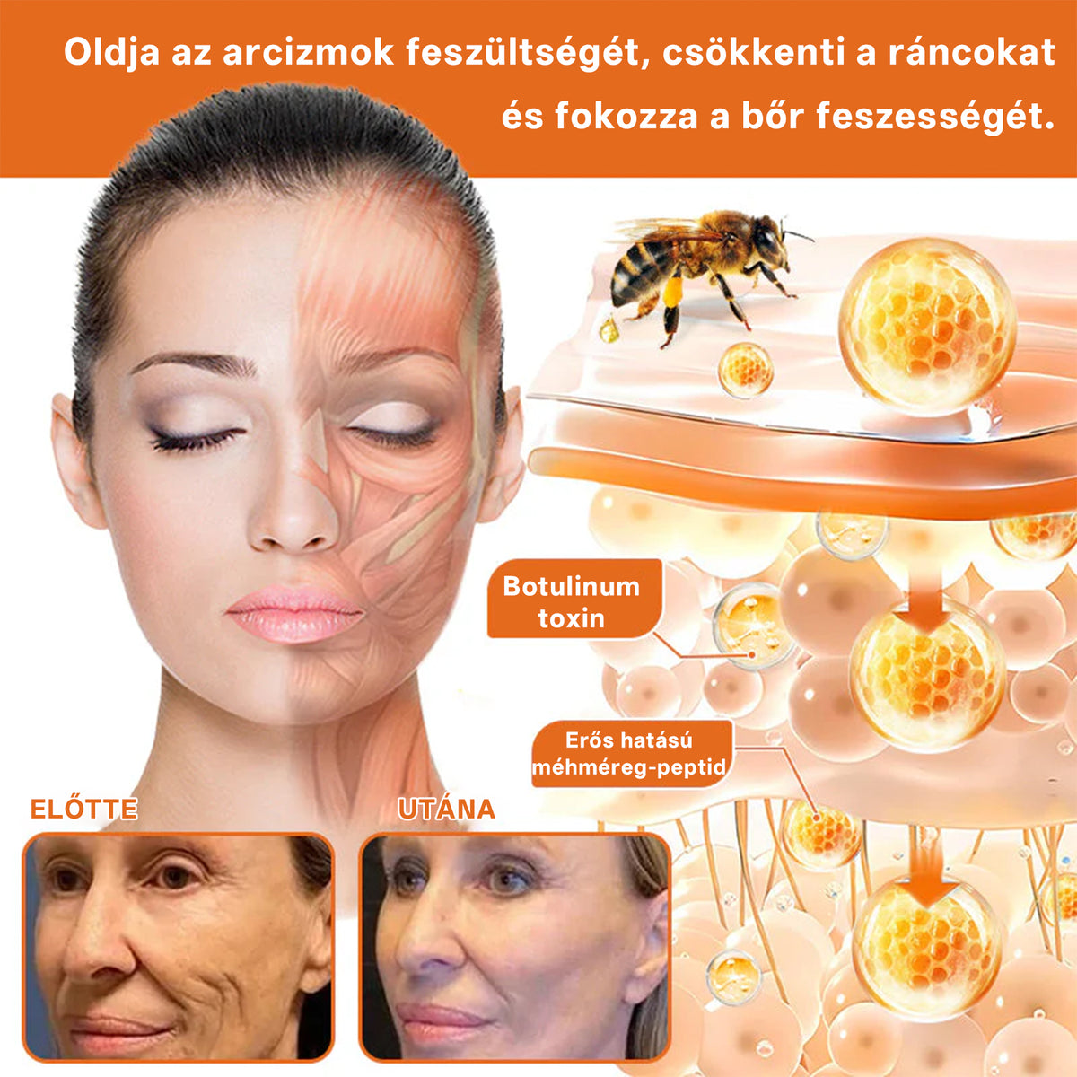 🔥 Hivatalos márkabolt | Mrevbsin® Méhméreg Pro Komplex Krém – Bőrfeszesítő minden bőrtípusra
