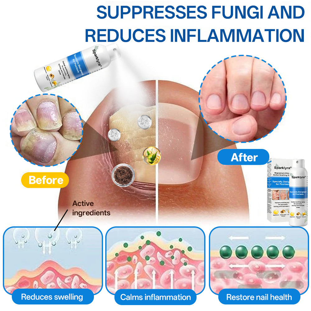 💥💥Official shop✅: Sparklyra® Herbal magnesium spray for psoriasis