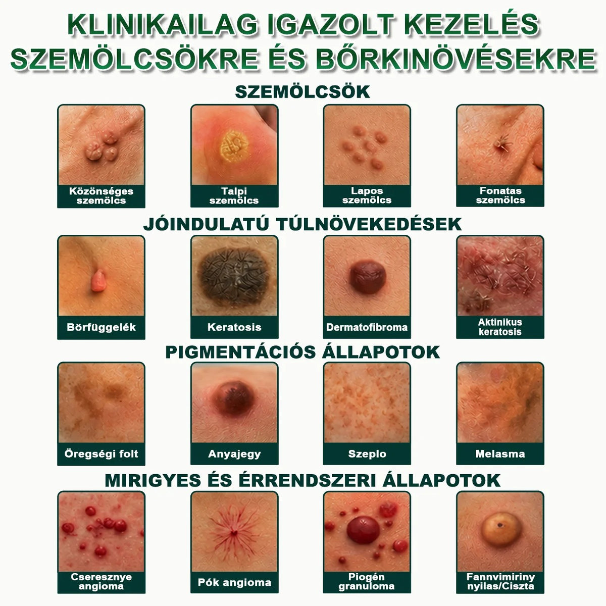🚚  Mrevbsin® 2 az 1-ben mikrotűs és hidrokolloid tapasz🧑‍⚕️ | Kiálló anyajegyek, aknék, lapos szemölcsök és bőrnövedékek eltávolítására | Segít csökkenteni a ráncokat, hegeket és bőrhibákat