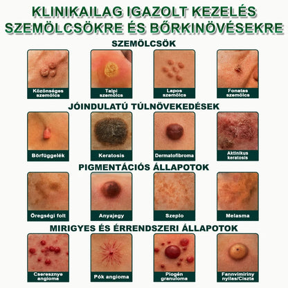 🚚  Mrevbsin® 2 az 1-ben mikrotűs és hidrokolloid tapasz🧑‍⚕️ | Kiálló anyajegyek, aknék, lapos szemölcsök és bőrnövedékek eltávolítására | Segít csökkenteni a ráncokat, hegeket és bőrhibákat
